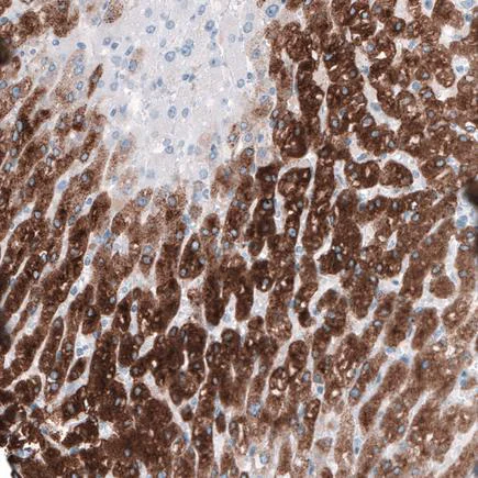 Immunohistochemistry (Formalin/PFA-fixed paraffin-embedded sections) - Anti-HSD17B13 antibody (AB122036)