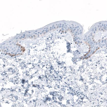 Immunohistochemistry (Formalin/PFA-fixed paraffin-embedded sections) - Anti-HSD17B13 antibody (AB122036)