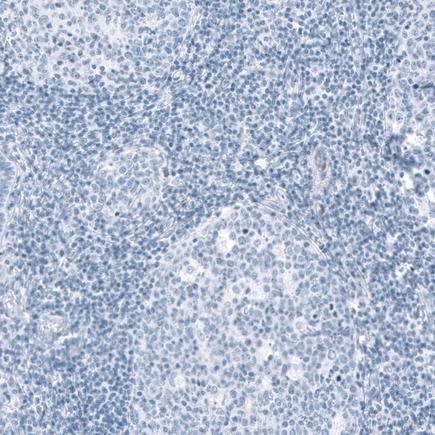 Immunohistochemistry (Formalin/PFA-fixed paraffin-embedded sections) - Anti-HSD17B13 antibody (AB122036)