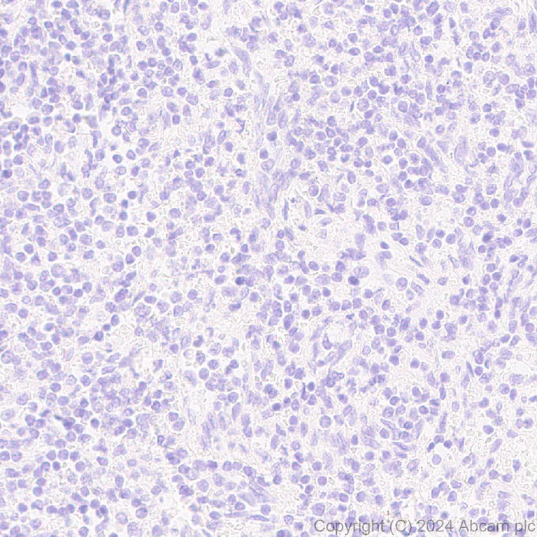 Immunohistochemistry (Formalin/PFA-fixed paraffin-embedded sections) - Anti-HSD17B13 antibody [EPR28344-54] (AB316153)