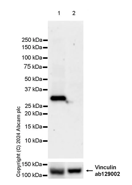 Western blot - Anti-HSD17B13 antibody [EPR28344-54] (AB316153)