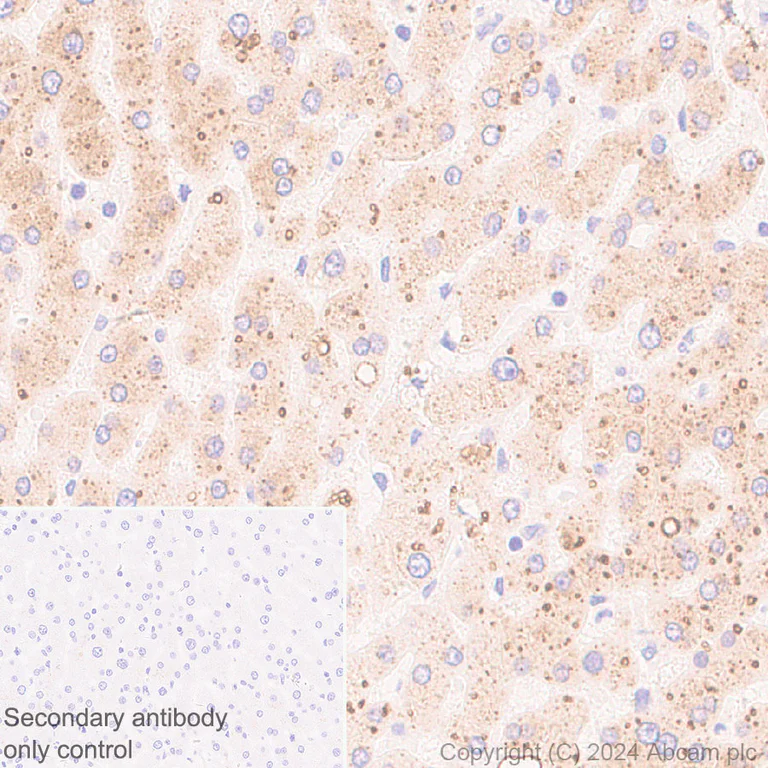 Immunohistochemistry (Formalin/PFA-fixed paraffin-embedded sections) - Anti-HSD17B13 antibody [EPR28344-54] - BSA and Azide free (AB316154)