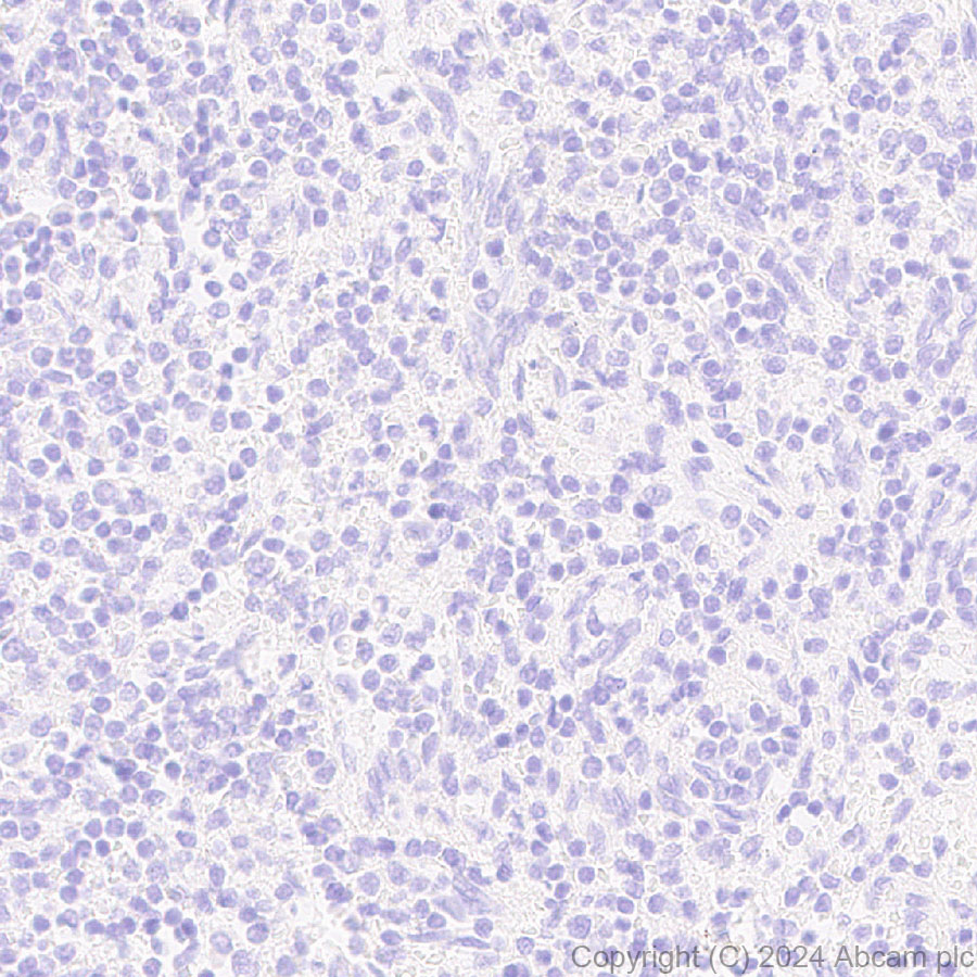 Immunohistochemistry (Formalin/PFA-fixed paraffin-embedded sections) - Anti-HSD17B13 antibody [EPR28344-54] - BSA and Azide free (AB316154), expandable thumbnail
