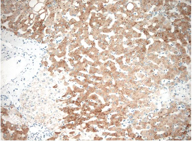 Immunohistochemistry (Formalin/PFA-fixed paraffin-embedded sections) - Anti-HSD17B13 antibody [OTI5C4] (AB279388)