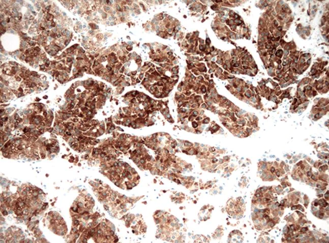 Immunohistochemistry (Formalin/PFA-fixed paraffin-embedded sections) - Anti-HSD17B13 antibody [OTI5C4] (AB279388)