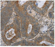 Immunohistochemistry (Formalin/PFA-fixed paraffin-embedded sections) - Anti-HSD17B14 antibody (AB198013), expandable thumbnail