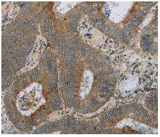 Immunohistochemistry (Formalin/PFA-fixed paraffin-embedded sections) - Anti-HSD17B14 antibody (AB198013)