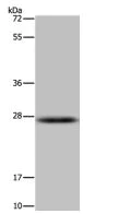 Western blot - Anti-HSD17B14 antibody (AB198013)