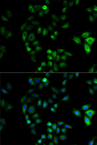 Immunocytochemistry/ Immunofluorescence - Anti-HSD17B2 antibody (AB196784), expandable thumbnail