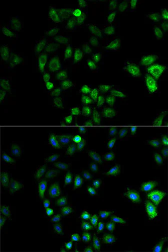 Immunocytochemistry/ Immunofluorescence - Anti-HSD17B2 antibody (AB196784)