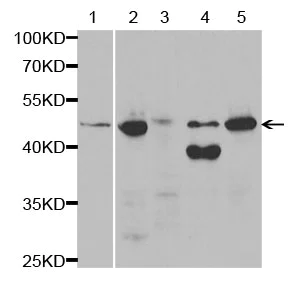 Western blot - Anti-HSD17B2 antibody (AB196784)