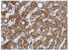 Immunohistochemistry (Formalin/PFA-fixed paraffin-embedded sections) - Anti-HSD17B3 antibody (AB126228), expandable thumbnail