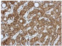 Immunohistochemistry (Formalin/PFA-fixed paraffin-embedded sections) - Anti-HSD17B3 antibody (AB126228)