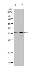 Western blot - Anti-HSD17B3 antibody (AB126228)