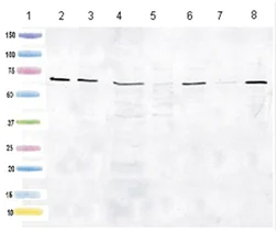 Western blot - Anti-HSD17B4 antibody [2D3BB5BF10] (AB128565)