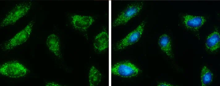 Immunocytochemistry/ Immunofluorescence - Anti-HSD17B4 antibody (AB97971)