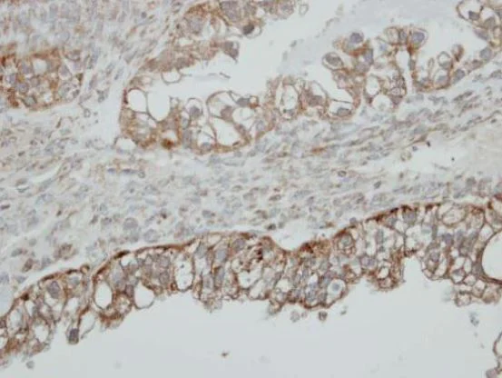 Immunohistochemistry (Formalin/PFA-fixed paraffin-embedded sections) - Anti-HSD17B4 antibody (AB97971)