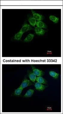 Immunocytochemistry/ Immunofluorescence - Anti-HSD17B4 antibody (AB97975)