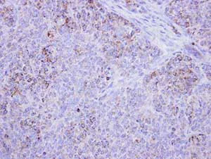Immunohistochemistry (Formalin/PFA-fixed paraffin-embedded sections) - Anti-HSD17B4 antibody (AB97975)