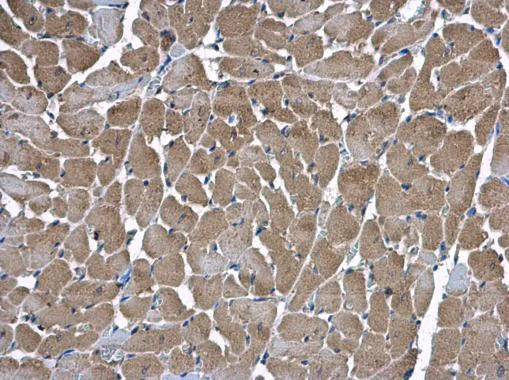 Immunohistochemistry (Formalin/PFA-fixed paraffin-embedded sections) - Anti-HSD17B4 antibody (AB97975)