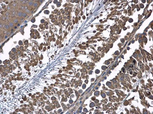 Immunohistochemistry (Formalin/PFA-fixed paraffin-embedded sections) - Anti-HSD17B4 antibody (AB97975)