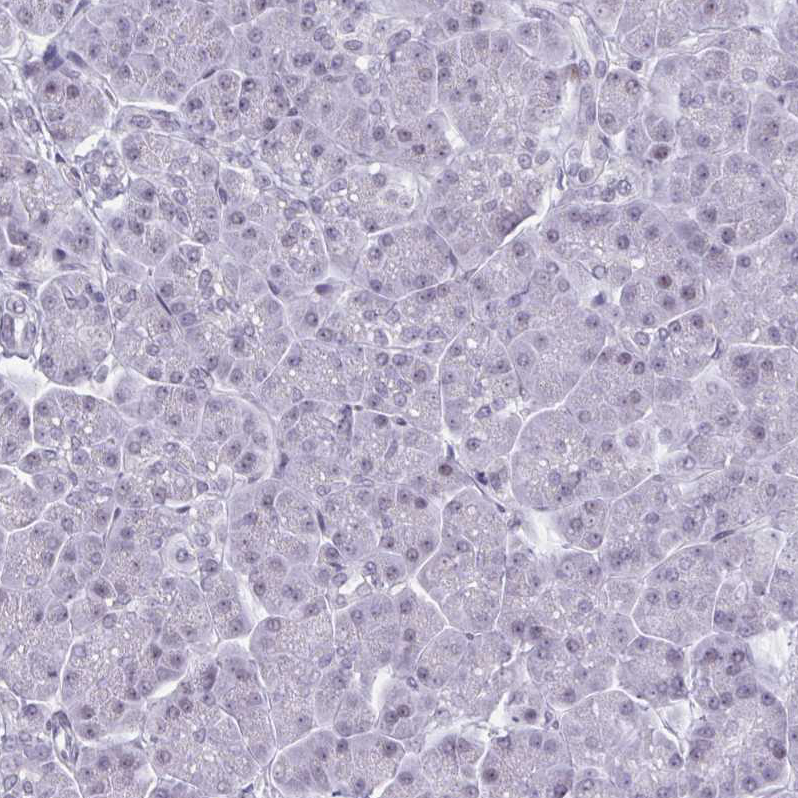 Immunohistochemistry (Formalin/PFA-fixed paraffin-embedded sections) - Anti-HSD17B6 antibody (AB272668)