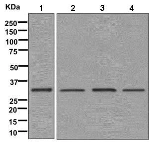 Western blot - Anti-HSD17B8 antibody [EPR12084(B)] - BSA and Azide free (AB249502)