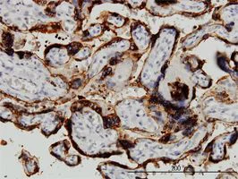 Immunohistochemistry (Formalin/PFA-fixed paraffin-embedded sections) - Anti-HSD3B1 antibody [3C11-D4] (AB55268)