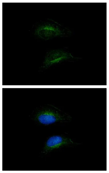 Immunocytochemistry/ Immunofluorescence - Anti-HSD3B2 antibody (AB154385)