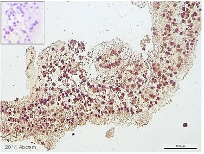 Immunohistochemistry (Formalin/PFA-fixed paraffin-embedded sections) - Anti-HSD3B2 antibody (AB154385)