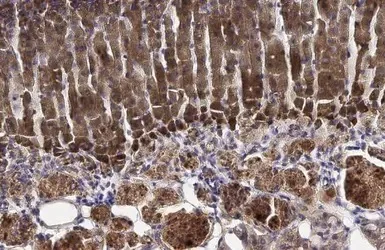 Immunohistochemistry (Formalin/PFA-fixed paraffin-embedded sections) - Anti-HSD3B2 antibody (AB154385)