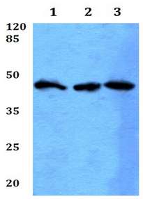 Western blot - Anti-HSD3B2 antibody (AB191515), expandable thumbnail