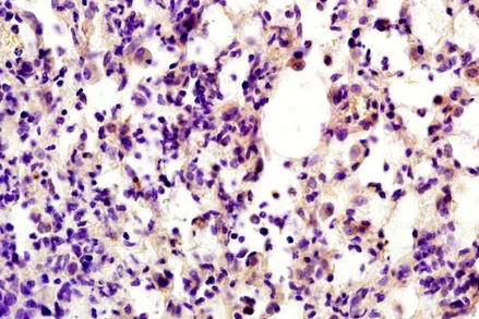 Immunohistochemistry (Formalin/PFA-fixed paraffin-embedded sections) - Anti-HSD3B7 antibody (AB203256)