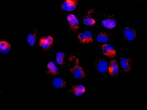 Immunocytochemistry/ Immunofluorescence - Anti-HSDL2 antibody [EPR13876(B)] (AB181174)