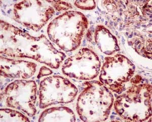Immunohistochemistry (Formalin/PFA-fixed paraffin-embedded sections) - Anti-HSDL2 antibody [EPR13876(B)] (AB181174)