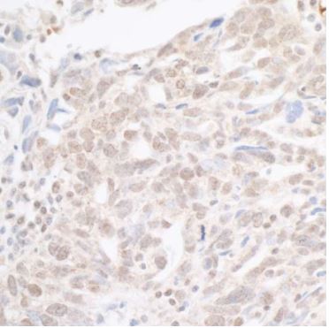 Immunohistochemistry (Formalin/PFA-fixed paraffin-embedded sections) - Anti-hSET1/SET1 antibody (AB70378)