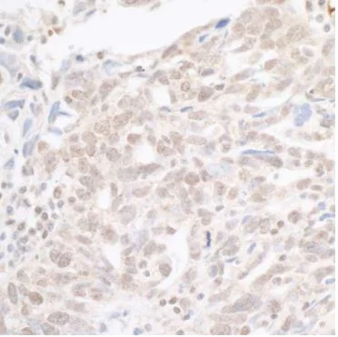 Immunohistochemistry (Formalin/PFA-fixed paraffin-embedded sections) - Anti-hSET1/SET1 antibody (AB70378)