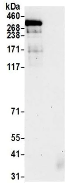 Immunoprecipitation - Anti-hSET1/SET1 antibody (AB70378)