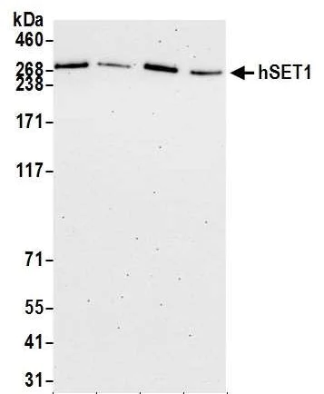 Western blot - Anti-hSET1/SET1 antibody (AB70378)
