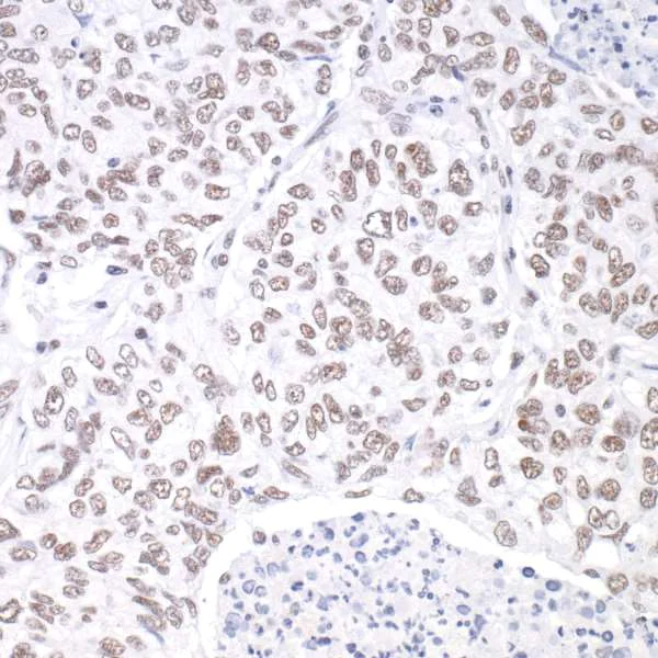 Immunohistochemistry (Formalin/PFA-fixed paraffin-embedded sections) - Anti-hSET1/SET1 antibody [BLR024E] (AB243881)