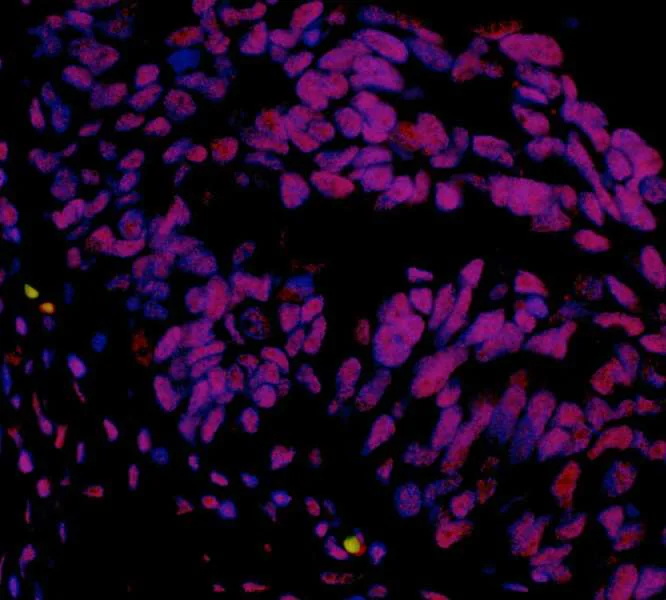 Immunohistochemistry (Formalin/PFA-fixed paraffin-embedded sections) - Anti-hSET1/SET1 antibody [BLR024E] (AB243881)
