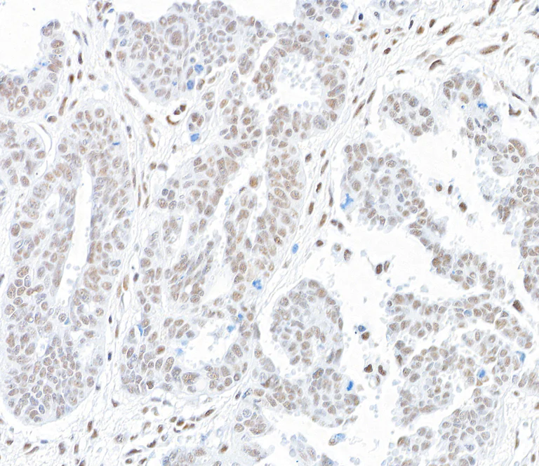 Immunohistochemistry (Formalin/PFA-fixed paraffin-embedded sections) - Anti-hSET1/SET1 antibody [BLR024E] (AB243881)
