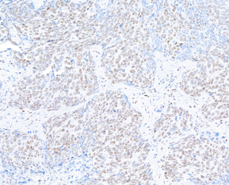 Immunohistochemistry (Formalin/PFA-fixed paraffin-embedded sections) - Anti-hSET1/SET1 antibody [BLR024E] (AB243881)