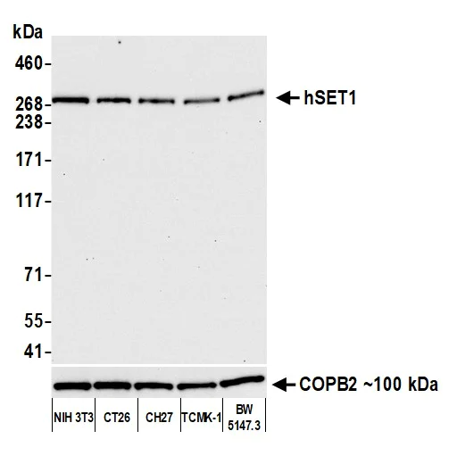 Western blot - Anti-hSET1/SET1 antibody [BLR024E] (AB243881)