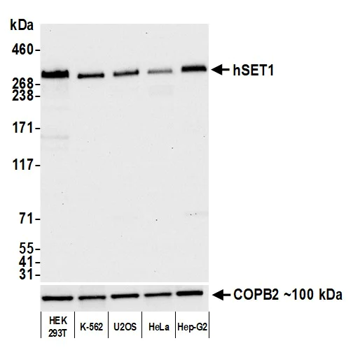 Western blot - Anti-hSET1/SET1 antibody [BLR024E] (AB243881)