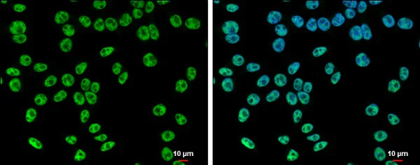 Immunocytochemistry/ Immunofluorescence - Anti-hSET1/SET1 antibody - C-terminal (AB229324)