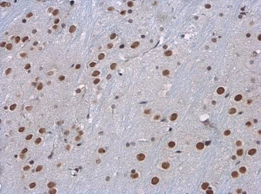 Immunohistochemistry (Formalin/PFA-fixed paraffin-embedded sections) - Anti-hSET1/SET1 antibody - C-terminal (AB229324)