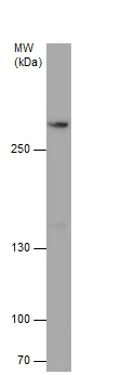 Western blot - Anti-hSET1/SET1 antibody - C-terminal (AB229324)