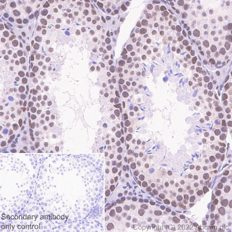 Immunohistochemistry (Formalin/PFA-fixed paraffin-embedded sections) - Anti-hSET1/SET1 antibody [EPR26821-25] - BSA and Azide free (AB307159)