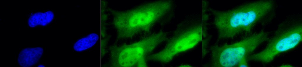 Immunocytochemistry/ Immunofluorescence - Anti-HSF1 antibody [10H8] (AB61382)